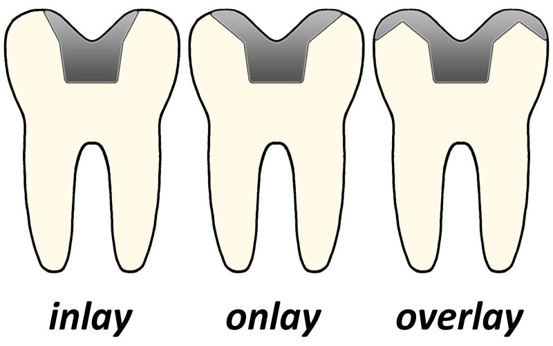 oral health care