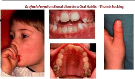 kids orthodontic treatment
