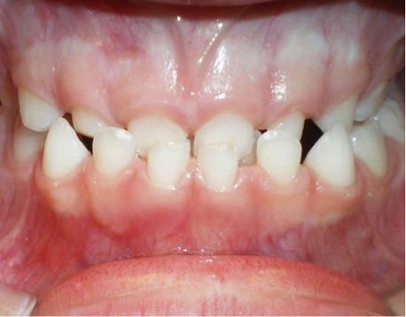 ortho dental care